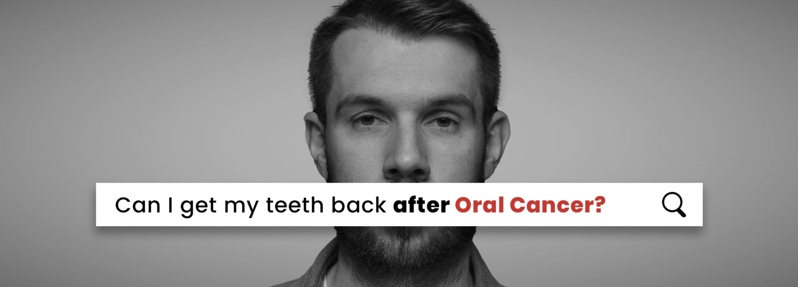 Oral Cancer Rehabilitation