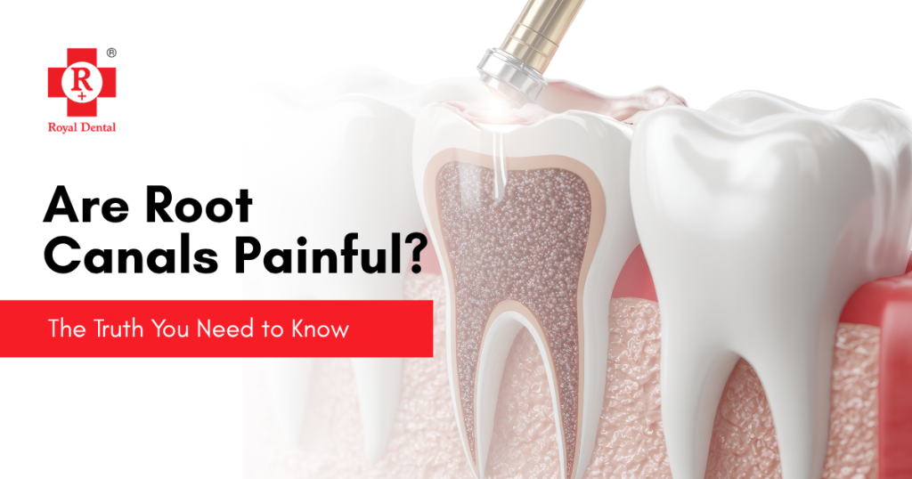 Root Canals Painful