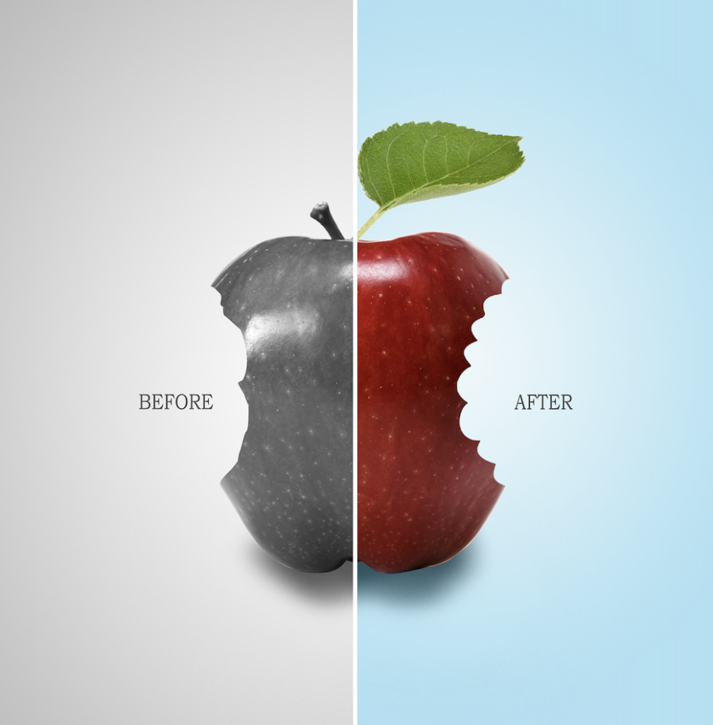 Denture treatment in Jaipur