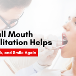 How Full Mouth Rehabilitation Helps You Eat, Speak, and Smile Again