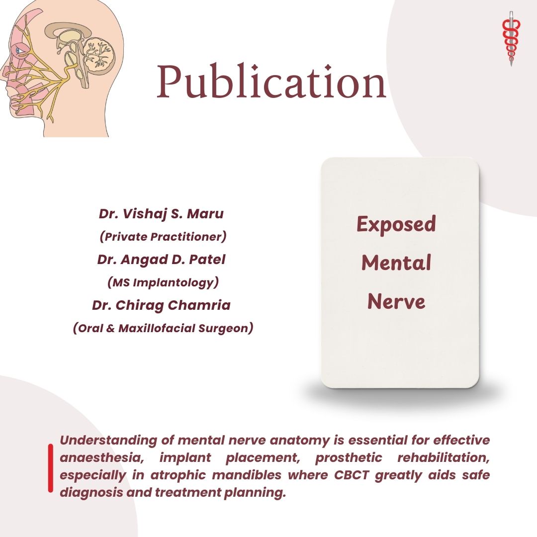 Publication - Exposed Mental Nerve