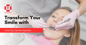 Transform Your Smile with One Day Dental Implants