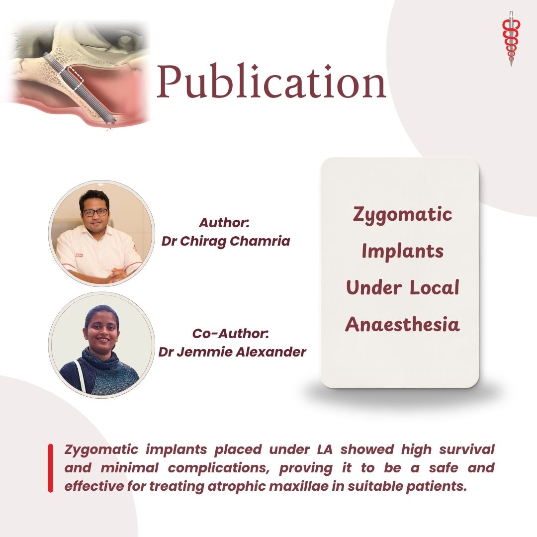 Zygomatic Implant Under Local Anesthesia