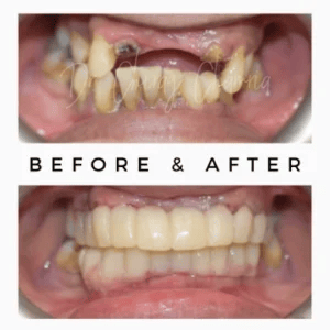 Cosmetic-Dentistry-BeforAfter-300x300