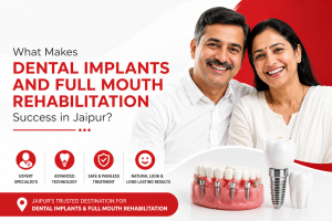 What Makes Dental Implants and Full Mouth Rehabilitation Success in Jaipur?