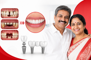 Can Old Crowns, Bridges and Missing Teeth Be Fixed Together?