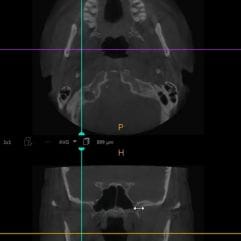In-house Dental Scan