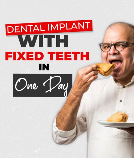 dental implant with fixed teeth in one day